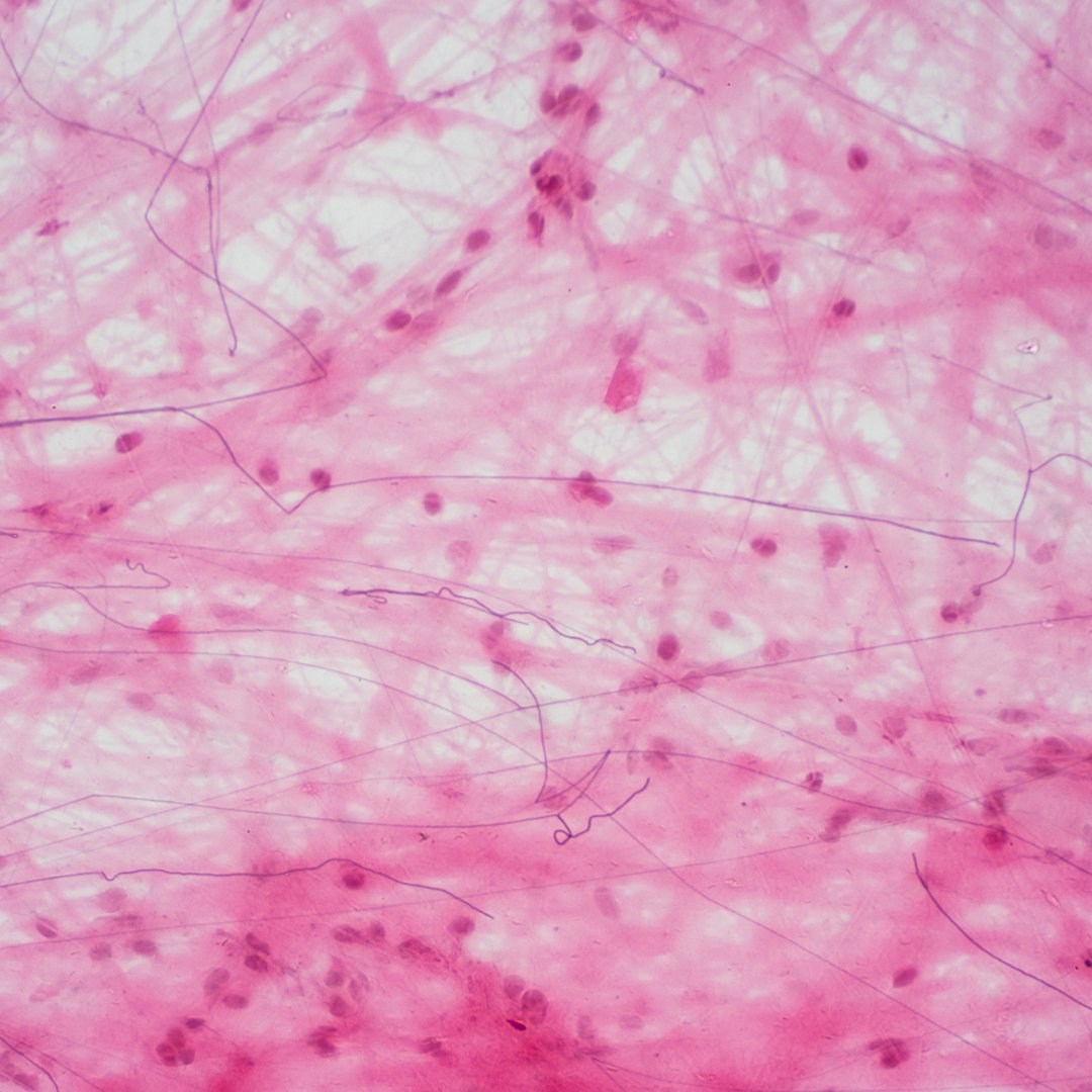 Collagen – exploring diverse benefits of this popular supplement