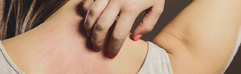 Understanding histamine intolerance