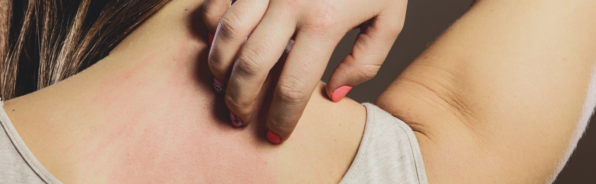 Understanding histamine intolerance