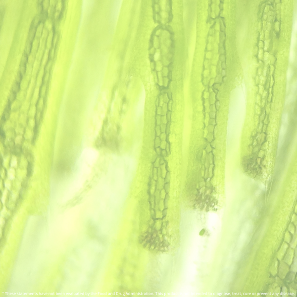 Microscopic view of plant cells under a microscope