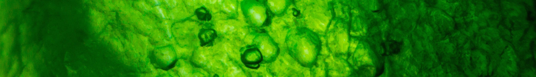 Close-up of green algae under a microscope